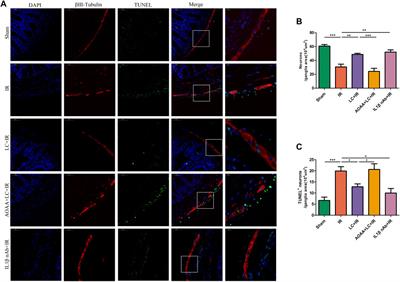 L-Cysteine Alleviates Myenteric Neuron Injury Induced by Intestinal Ischemia/Reperfusion via Inhibitin the Macrophage NLRP3-IL-1β Pathway